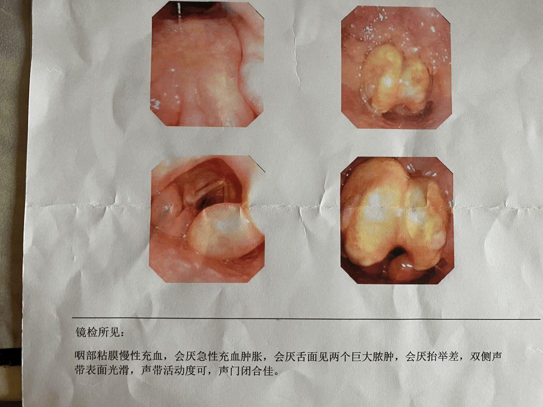 呼吸不暢危及生命當孕婦遇見喉炎因為朋友圈的評論救了一條人命